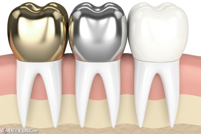 How Much Do Dental Crowns Cost In Austin How Much Do Dental Crowns Cost In Austin